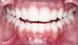 periodontist in savannah encourages flossing